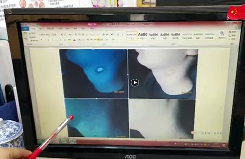 浓情端午·粽享公益丨夏季白癜风专项诊疗助力行动 浓情端午·粽享公益丨夏季白癜风专项诊疗助力行动